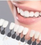 מעבר למצופה: היתרונות של טיפולי ציפוי שיניים -תמונה